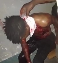 Machete Fails to Behead Solider.