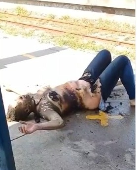 Woman Doused with Gasoline, Sets on Fire in Brutal Attack (More Footage)