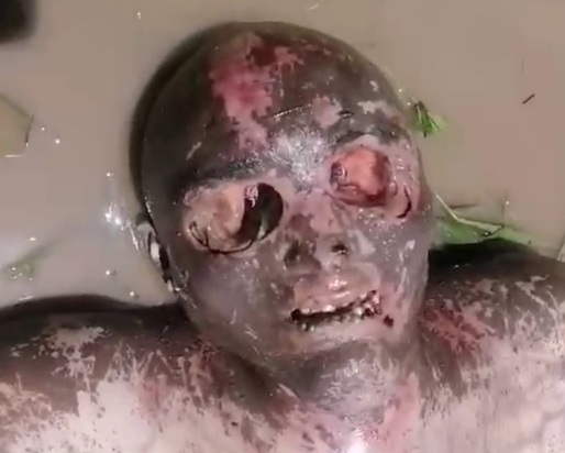 [EYES POPPED OUT]Rotten dead Body found in the Magdalena River