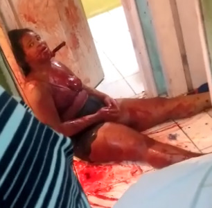 Knife Attack Left Woman In The Pool Of Blood 