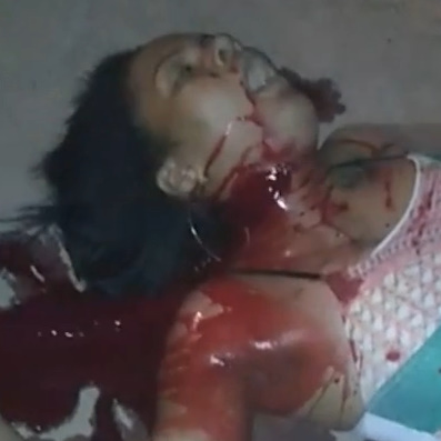 Woman With Open Throat Agonizes to Death