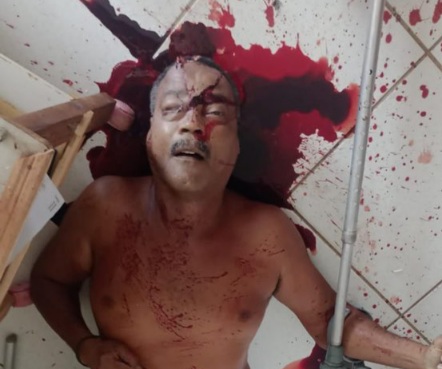 70-year-old Brazilian man is shot dead