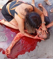 Man's Throat Gets Cut And Bleeds To Death In Public (CCTV & Aftermath)