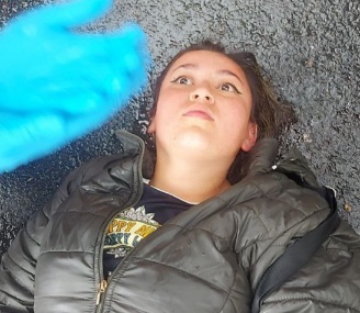 Young woman victime of electric scooter crash 