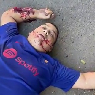 Brazilian fat man killed