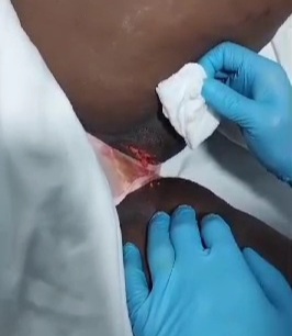 Wife stabbed in her vagina and ander her tits by abusive husband 