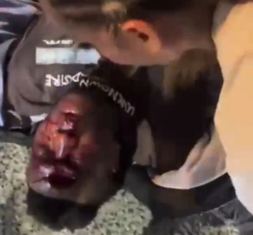 Motorcyclist with hole in his front 