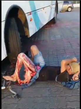 Damn, victim had his leg shattered