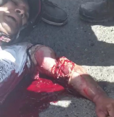 Motorcyclist gored by bus 