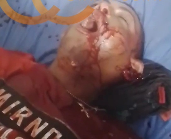 LAST GASPS OF AIR AFTER GETTING A HEADSHOT FROM SICARIO 