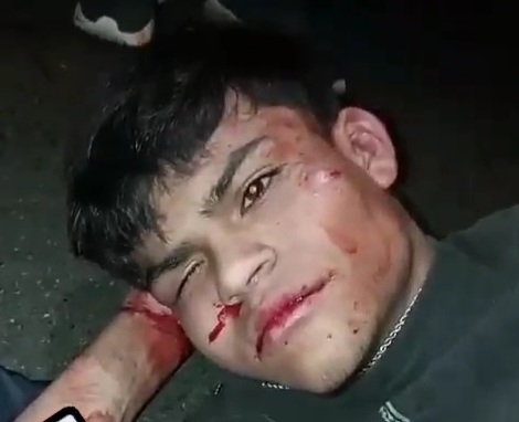 Sicario captured and punished hard after killing old man 