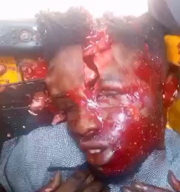 Rival head split in half by the BLACK AXE GANG MEMBERS 