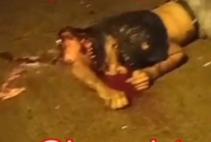 [BRAIN ON THE ASPHALT]CITIZEN WAS COMPLETELY CRUSHED BY A VEHICLE