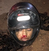 Helmets Don't Always Help.