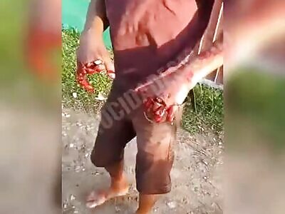 Thief's Cut Off Fingers