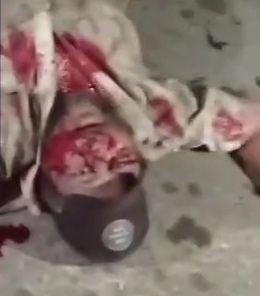 Fat man executed by sicario 