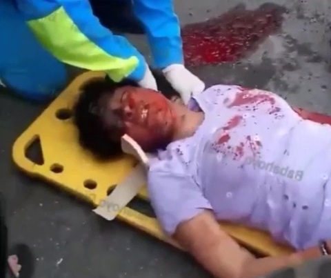 Couple victims of motorcycle accident 