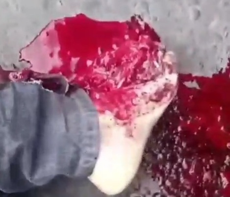 Biker leg crashed under bus wheel 