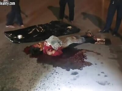 Teen on a Motorbike Collided with an Electric Tricycle