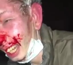 RUSSIAN DEBT COLLECTOR SMASHING FACE AND FINGERS OF INDEBTED JUNKIE 