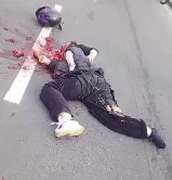 Truck Squeezed the Entire Organ Complex out of Girl