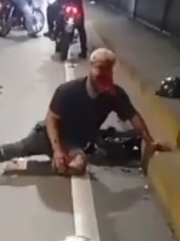 Biker Loses his Full Blown Face in Accident.