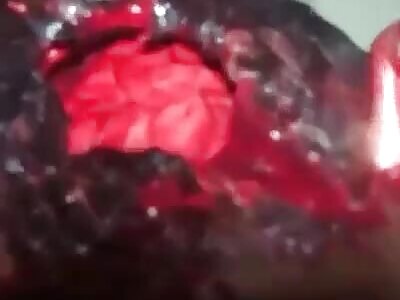 A man with a deep hole in his head