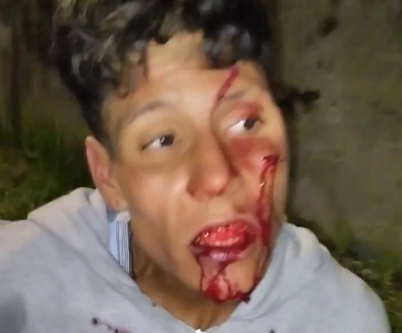 Thief punished hard for trying to steal motorcycle 