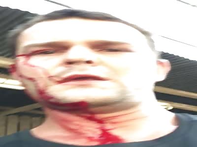 Sword Attack Victim Sending Goodbye Message to His Family on Cam