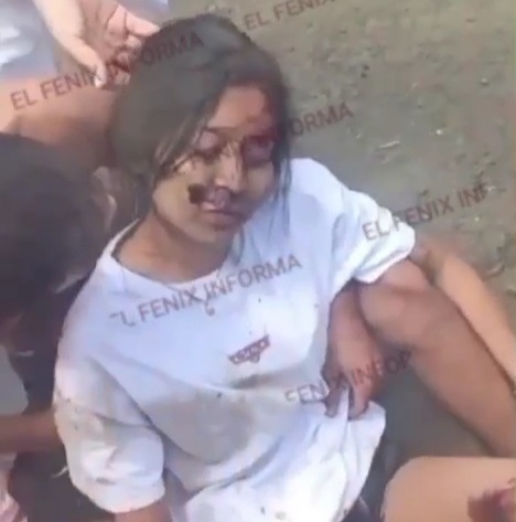 Cute Girl Suffers Horrific Accident.