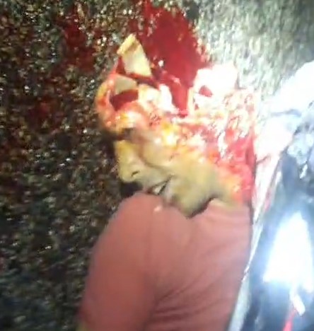 man had his head crushed in accident in Brazil