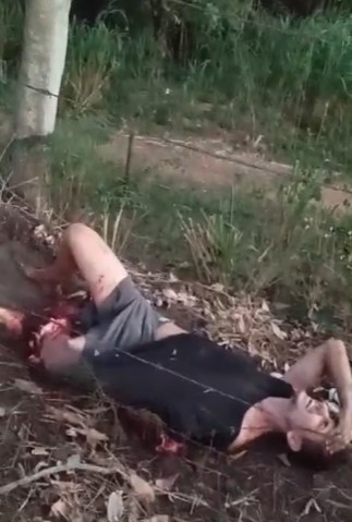 Brazilian biker has arm and leg ripped off
