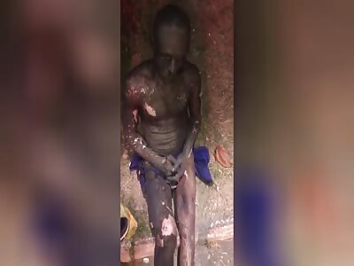  Electroshock Turns White Man Black