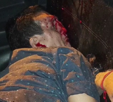 Drunk driver returned from party crashed dead 