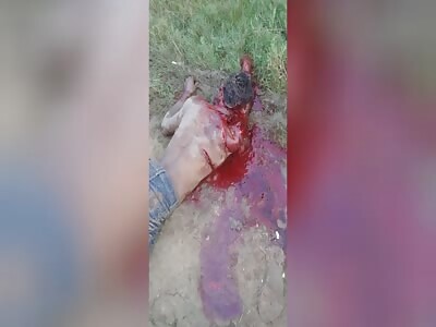 Damn, Dude Horribly Attacked with ZMachete Still Alive