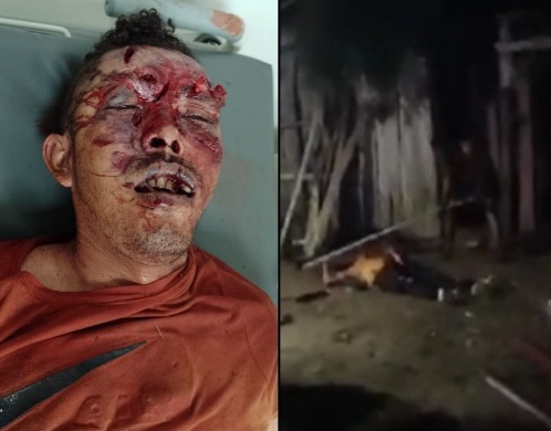 Drunk fight leaves 1 dead and one injured in canalete Colombia 