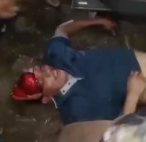 [SCALPED HEAD]Horrific footage of driver killed in traffic accident 