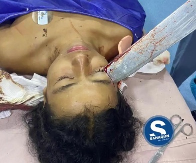 [UPDATE]REMOVING THE MACHETE STUCK IN THE GIRL FACE 