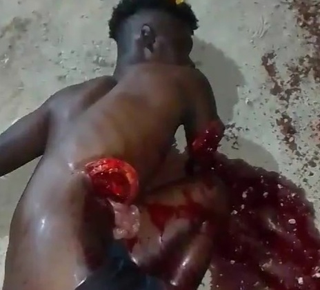 [HORROR FROM HAITI]YOUNG MAN GORED BY MACHETE DURING FIGHT 