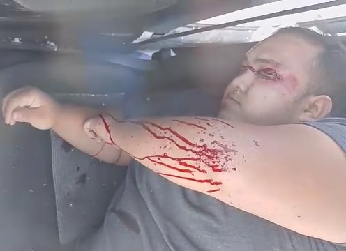 Stupid driver crashed hard 