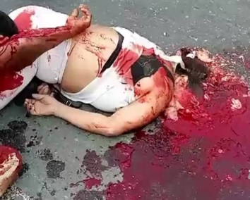 [BRAIN ON THE ASPHALT]COUPLE ON MOTORCYCLE CRASHED DEAD BY TRUCK 