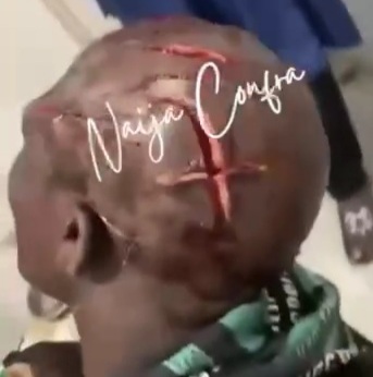 Head sliced after gang attack on civilian 