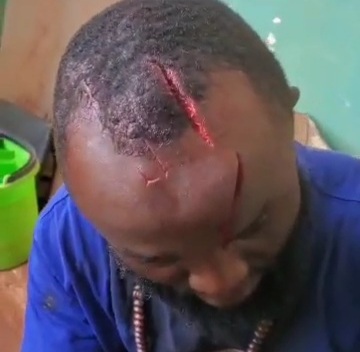Thief captured red handed gets some machete wound to the head 