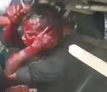 officer trapped in his patrol car killed by Bangladeshi protesters 