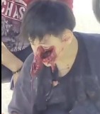 Just a Scratch bro.....