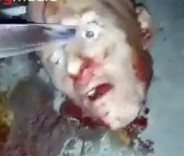 Digging the Eye from a Decapitated Head Using a Knife