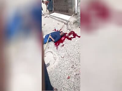 Protestor Shot In The Head