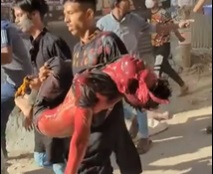 Protestor's Head Blown Open