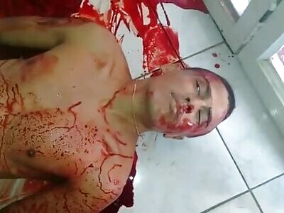 Thug Agonal Breathing and Moaning