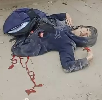 Disturbing Video Shows Man Ripped in Half and Still Alive